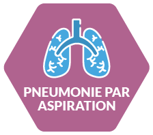 Pneumonie de déglutition