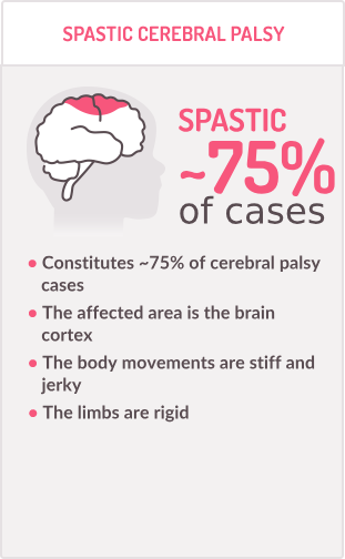 illlustrations differents types of cp